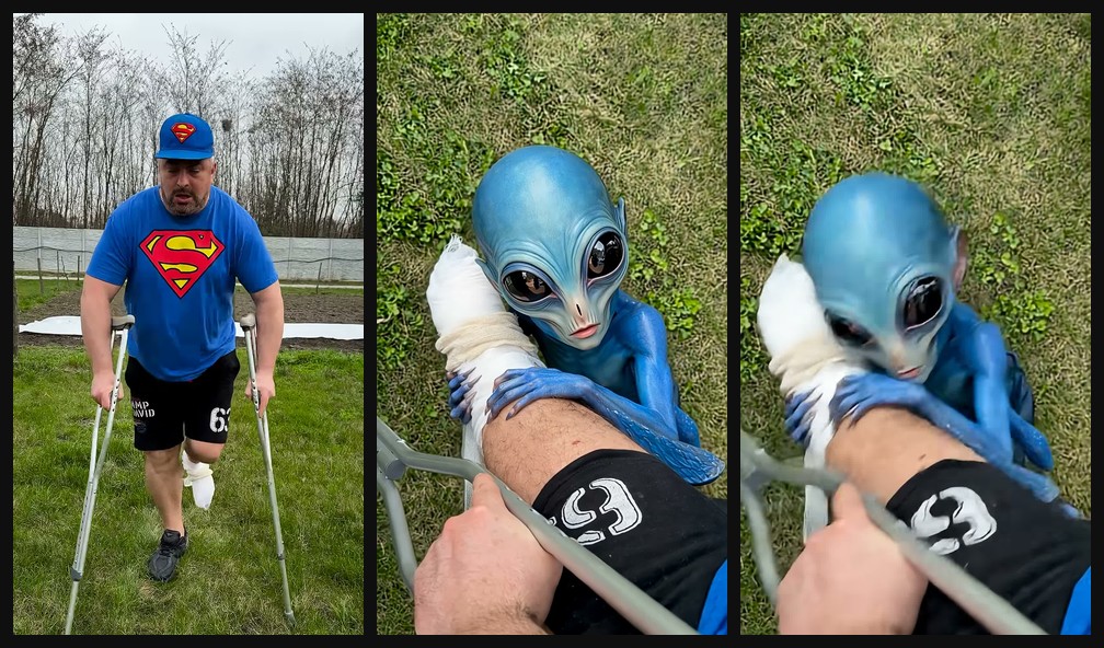 Injured man turns into the alien on crutches opening hook frames